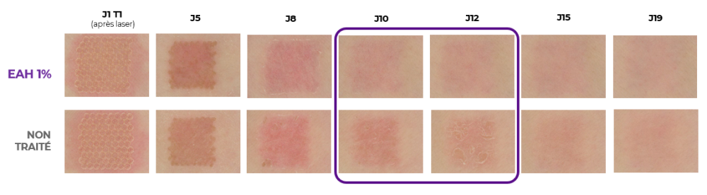 EPITHELIALE ULTRA REPAIR - FICHE PRODUIT