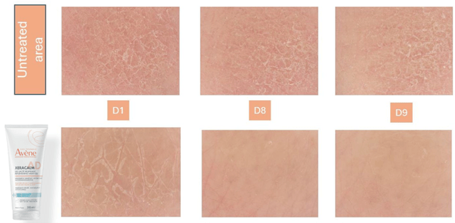 Résultats avec images, milky gel