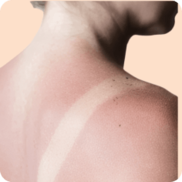 Protection solaire