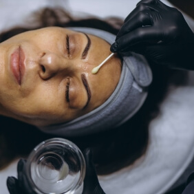 visuel peeling fiche conseil