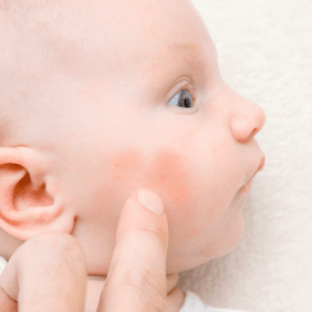 joues rouges bébé large