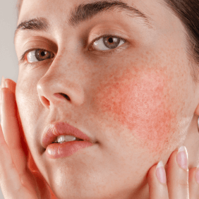 Visuel fiche conseil EXOMEGA Visage