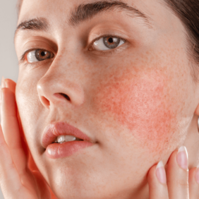 Visuel fiche conseil EXOMEGA Visage