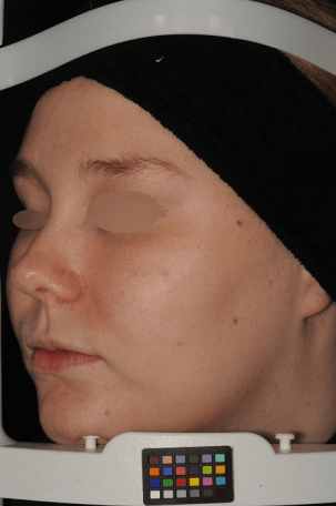 After P002T02Z13_RV5259A2024034 (1)