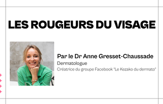 CARD Eczéma du visage