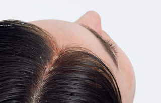 du_kelual ds_sebocontrol_treatment-shampoo_hair_pathology_4x5