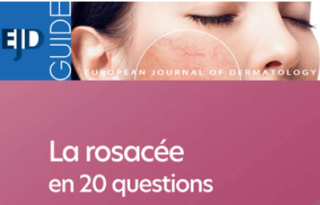 La rosacée en 20 questions