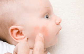 joues rouges bébé large