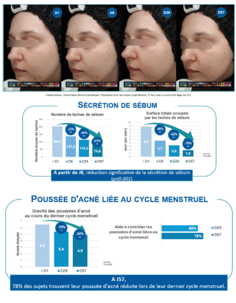 Graphe - Résultat clinique