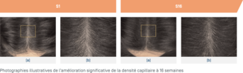 Creatism · Amélioration densité capillaire