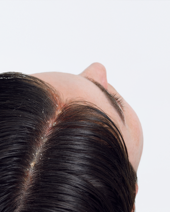du_kelual ds_sebocontrol_treatment-shampoo_hair_pathology_4x5