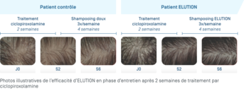 Elution · Photos illustratives
