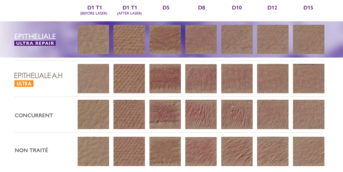 EPITHELIALE ULTRA REPAIR 1% - IMAGERIE 3D