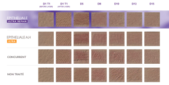 EPITHELIALE ULTRA REPAIR 1% - IMAGERIE 3D