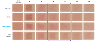 EPITHELIALE ULTRA REPAIR - RESULTATS IMAGERIE CLASSIQUE