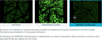 Fluorescence 