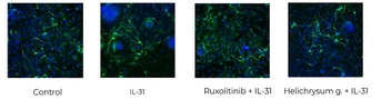 Co-culture of sensory neurons and keratinocytes