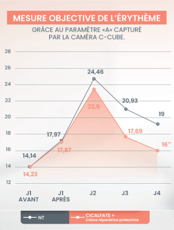 Mesure objective de l'érythème