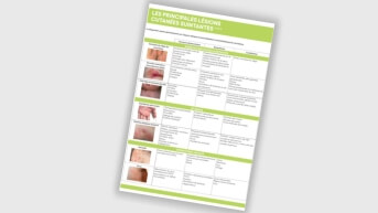 Les principales lésions suintante