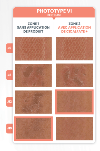 visualisation de Best case