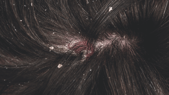 Cuir chevelu DS DUCRAY