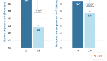 Kéracnyl Mat · Évolution de l'indice lipidique-1