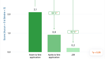 Sensinol Lait · Xerose