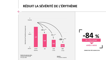 Slide 3 exomega