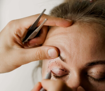 visuel blépharoplastie fiche conseil