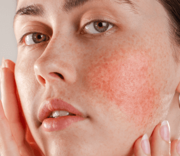 Visuel fiche conseil EXOMEGA Visage