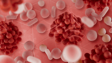 xera calm technologie d'action